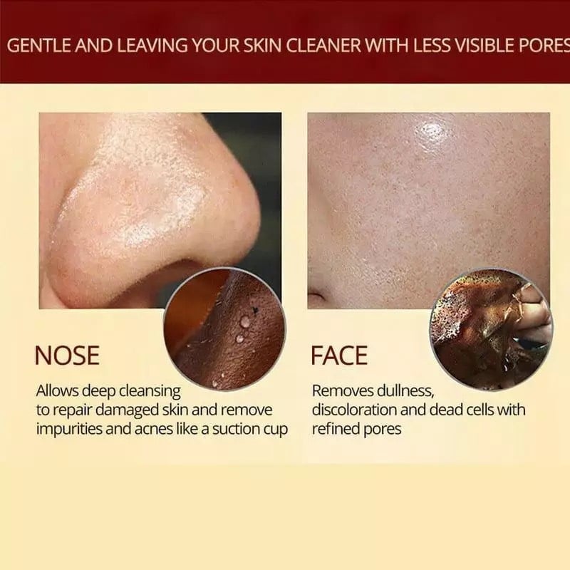 🔥Herbal Refining Peel-Off Facial Mask