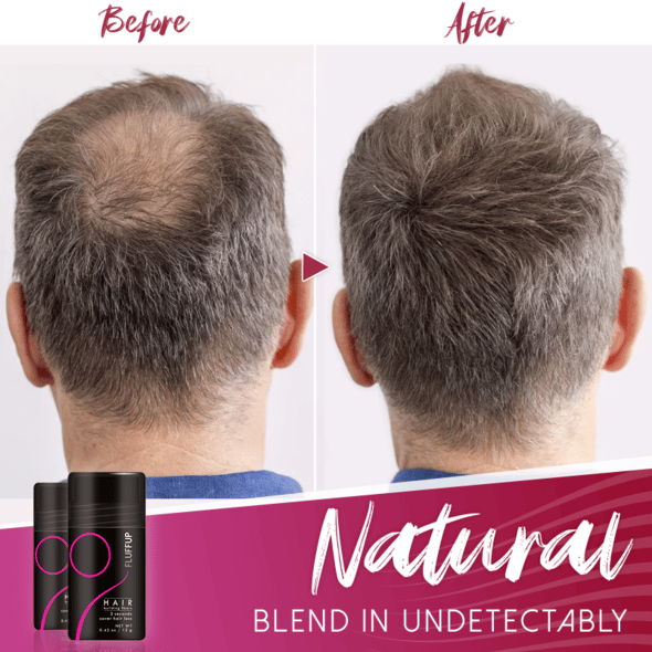 🔥🔥 - Fluffup secret hair fiber powder-Effective hair supplement